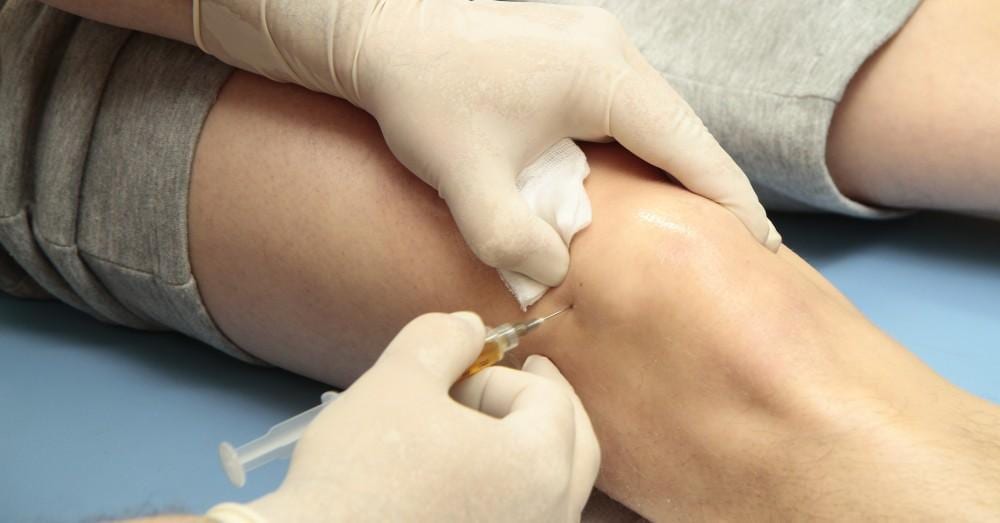 Shockwave therapy for tennis elbow at Physio Tullamore