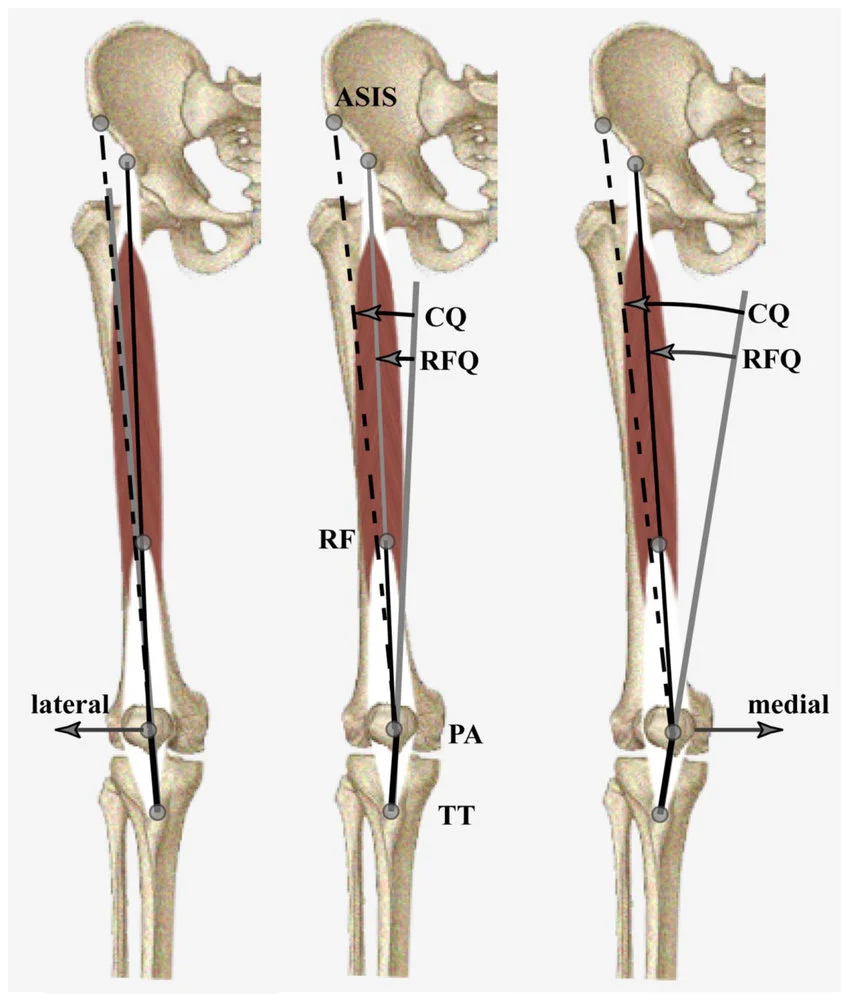 Patella tracking and knee biomechanics