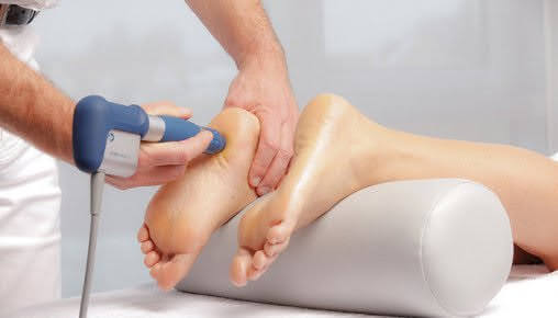 Shockwave therapy for plantar heel pain at Physio Tullamore
