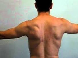 Scapular dyskinesis rehabilitation at Physio Tullamore